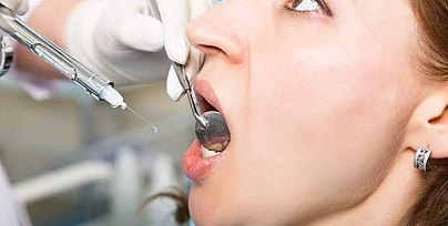 Лечение пульпита